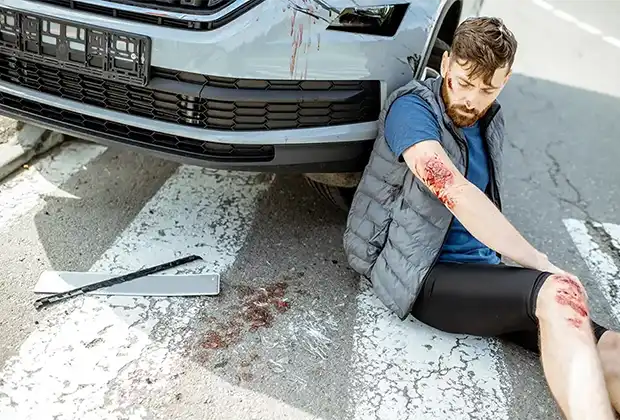 Un Hombre Resultó Herido Tras Un Accidente Peatonal